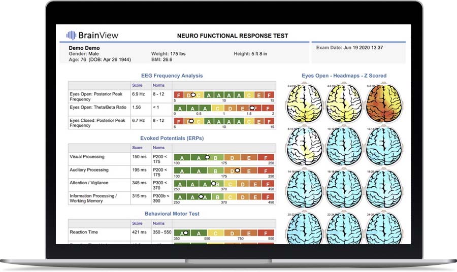 brainview.com ChatGPT ad — FDA-Cleared Brain Mapping in AI Drug Discovery & Computational Biology Platforms