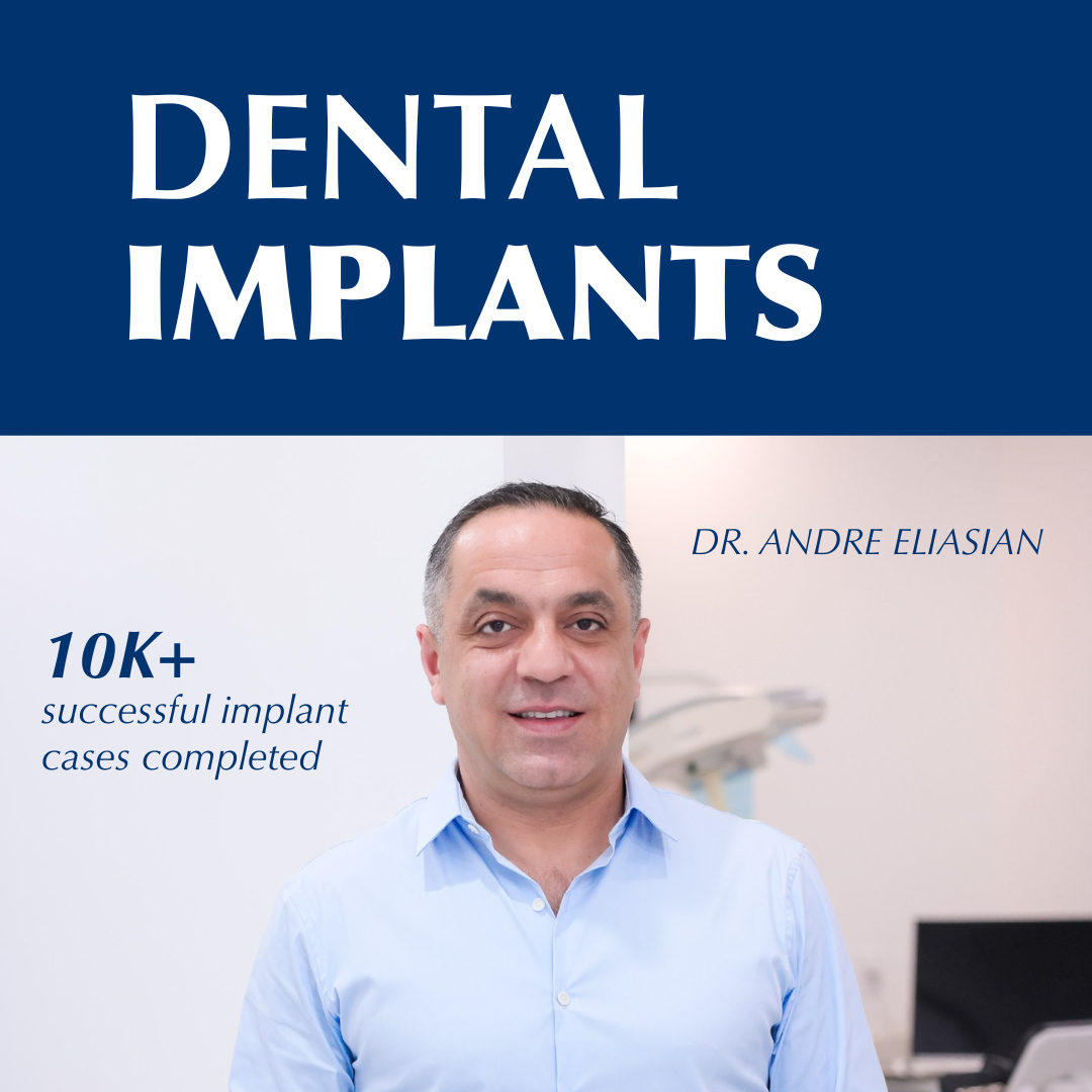 Elite Dental Group ChatGPT ad — Full Mouth Dental Implants in LA