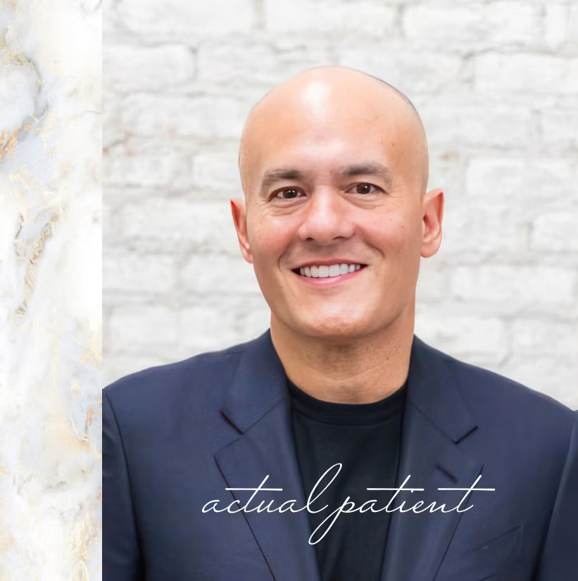 Scott Young, DDS ChatGPT ad — Custom Veneers by Dr. Scott Young